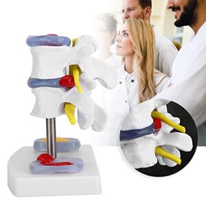 Wene Human Spine Model, Professional Vivid Lumbar Model Clearly Study with 2 Diseased Intervertebral Discs for School