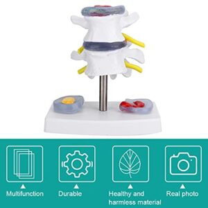 Wene Human Spine Model, Professional Vivid Lumbar Model Clearly Study with 2 Diseased Intervertebral Discs for School