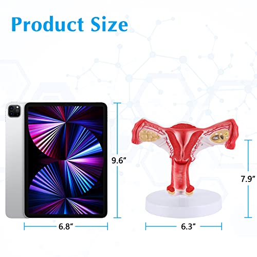 SKUMOD Uterus and Ovary Model Anatomical Model of Female reproductive Organs with Brackets Showing Anatomical Model of Uterus, Ovaries, Medical Teaching Tool