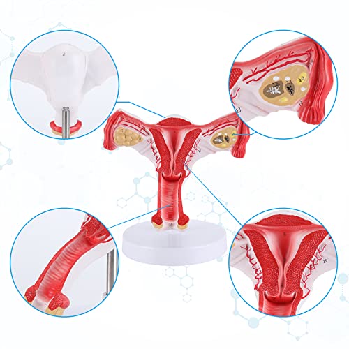 SKUMOD Uterus and Ovary Model Anatomical Model of Female reproductive Organs with Brackets Showing Anatomical Model of Uterus, Ovaries, Medical Teaching Tool