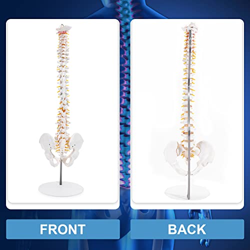 Winyousk Medical Spine Model, Life Size Flexible Anatomical Human Spine Model, Spine Model with Vertebrae, Nerves, Arteries, Lumbar Column and Male Pelvis - Mount on a Stand