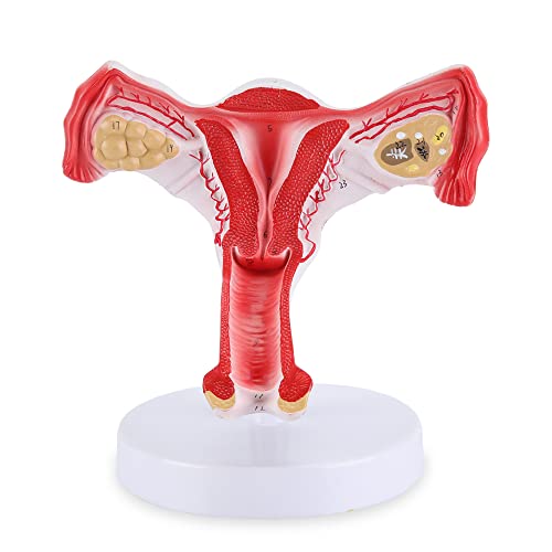 XKiss Human Uterus and Ovary Model, Female Reproductive Organ Model, Life Size Uterine Medical Educational Tool for Anatomical Gynecology Doctor Patient Communication Simulation