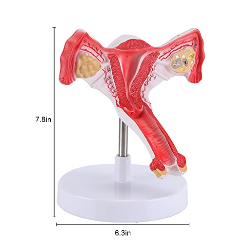 XKiss Human Uterus and Ovary Model, Female Reproductive Organ Model, Life Size Uterine Medical Educational Tool for Anatomical Gynecology Doctor Patient Communication Simulation