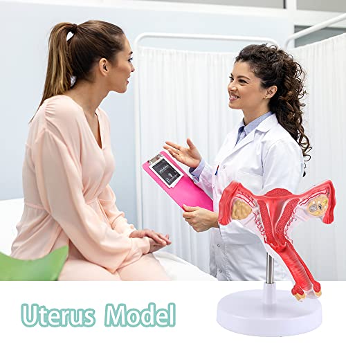 XKiss Human Uterus and Ovary Model, Female Reproductive Organ Model, Life Size Uterine Medical Educational Tool for Anatomical Gynecology Doctor Patient Communication Simulation