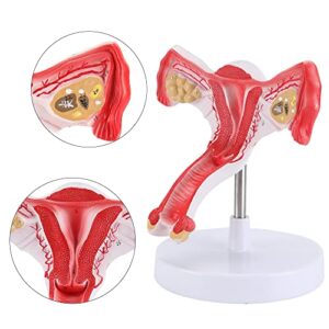 XKiss Human Uterus and Ovary Model, Female Reproductive Organ Model, Life Size Uterine Medical Educational Tool for Anatomical Gynecology Doctor Patient Communication Simulation