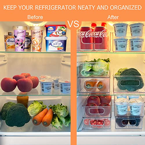 UCHIHA Set of 9 Refrigerator Organizer Bins - Clear Stackable Fridge Organizer Plastic Storage Bins for Freezer, Kitchen, Countertops, Cabinets - Pantry Organization and Storage Bins, ‎Transparent