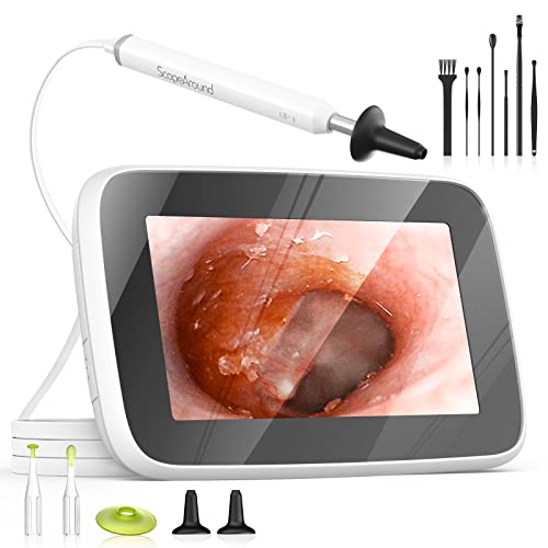 ScopeAround Digital Otoscope with Light, Ear Cleaning Camera and Wax Remover, Visual Ear Cleaner with 4.3" IPS Screen, 6 LED Lights, HD Video Ear Scope Camera, Supports Photo Snap and Video Recording