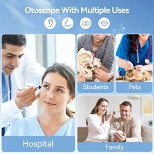 ScopeAround Digital Otoscope with Light, Ear Cleaning Camera and Wax Remover, Visual Ear Cleaner with 4.3" IPS Screen, 6 LED Lights, HD Video Ear Scope Camera, Supports Photo Snap and Video Recording