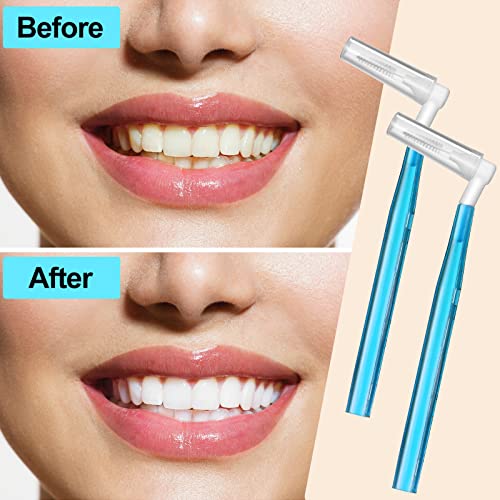 Jutom 100 Pcs Interdental Brush Tooth Floss Brush for Teeth Toothpick with Refill Heads Micro Tight Dental Picks for Teeth Cleaning Disposable Toothbrush Flossing Oral Braces Toothbrush (Blue)