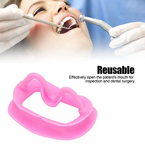 2pcs Mouth Opener, Silicone Silicone Cheek Retractor, Reusable Portable Dental Oral Cheek Flexible Retracto for Oral Mouth Opener Dental Challenge Game[pink]