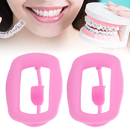 2pcs Mouth Opener, Silicone Silicone Cheek Retractor, Reusable Portable Dental Oral Cheek Flexible Retracto for Oral Mouth Opener Dental Challenge Game[pink]