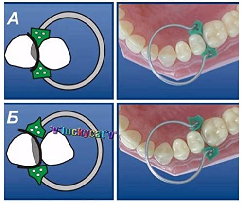 Tazrigo 100Pcs/Set Dental Sectional Contoured Matrices Matrix Ring Delta with 40Pcs Add-On Wedge