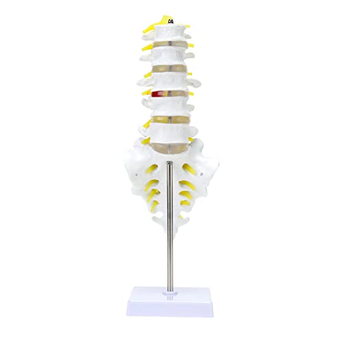 MIIRR Life Size Lumbar Spine Anatomical Model with A Herniated Disc at L4, Lumbar Spine Model with Sacrum and Spinal Nerves