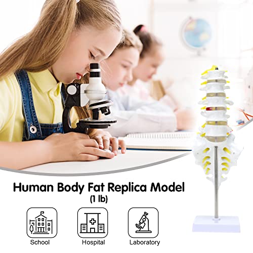 MIIRR Life Size Lumbar Spine Anatomical Model with A Herniated Disc at L4, Lumbar Spine Model with Sacrum and Spinal Nerves