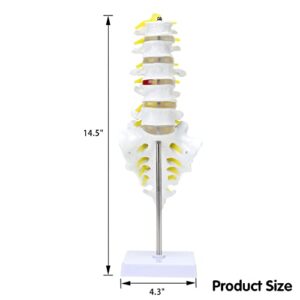 MIIRR Life Size Lumbar Spine Anatomical Model with A Herniated Disc at L4, Lumbar Spine Model with Sacrum and Spinal Nerves