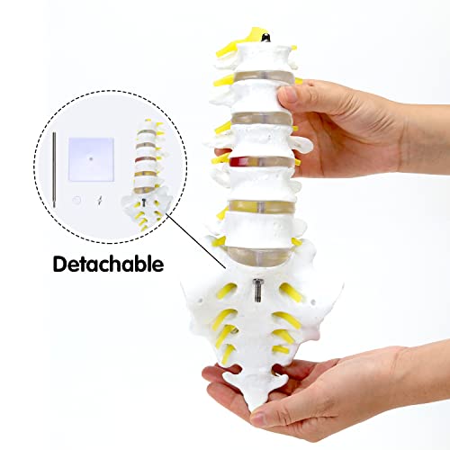 MIIRR Life Size Lumbar Spine Anatomical Model with A Herniated Disc at L4, Lumbar Spine Model with Sacrum and Spinal Nerves