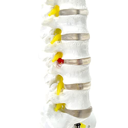 MIIRR Life Size Lumbar Spine Anatomical Model with A Herniated Disc at L4, Lumbar Spine Model with Sacrum and Spinal Nerves