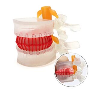 MIIRR Human Lumbar Disc Herniation Model, Transparent Medical Model of Vertebral Spine Anatomy with Elastic Software, Perfect for Learning and Teaching Tool