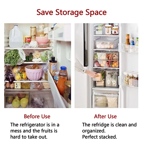 xhongz 3 Pack Stackable Refrigerator Organizer Bins with Pull-out Drawer, Clear Fridge Drawer Organizer with Handle, Large Drawable Storage Cases for Pantry Organization, Kitchen, Cabinet, Freezer