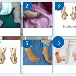 Kids AFO Drop Foot Splint Baby Ankle Foot Brace Night Splint Toddler Strephenopodia Strephexopodia Splint (20cm)