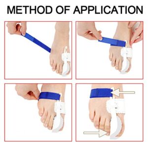 AnHua Valgus Bunion Corrector Orthotics Feet Bone Thumb Adjuster Correction Pedicure Sock Straightener Bunion Splint for Bunions For Crooked Toes Alignment Pain Relief (Style2：Blue white)