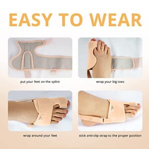 PEDIGOO Bunion Corrector for Women and Men, Slip Proofing Version Bunion Toe Separator, Orthopedic Bunion Splint for Big Toe Pain Relief and Toe Straightening Beige