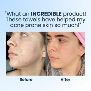 Clean Skin Club Clean Towels XL Travel, 3 Pack USDA Certified 100‪%‬ Biobased Dermatologist Approved Face Towel, Disposable Face Towelette, Facial Washcloth, Makeup Remover Dry Wipes, Ultra Soft, 30CT