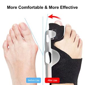 MMPANG Bunion Corrector for Women & Men 2Pcs Bunion Straightener Day/Night Support Orthopedic Bunion Relief Splint Non-Slip/Adjustable/Comfortable/Breathable Big Toe Corrector for Hallux Valgus