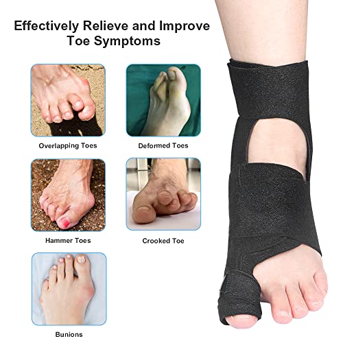 MMPANG Bunion Corrector for Women & Men 2Pcs Bunion Straightener Day/Night Support Orthopedic Bunion Relief Splint Non-Slip/Adjustable/Comfortable/Breathable Big Toe Corrector for Hallux Valgus