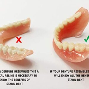 Lower Denture Stabilizers