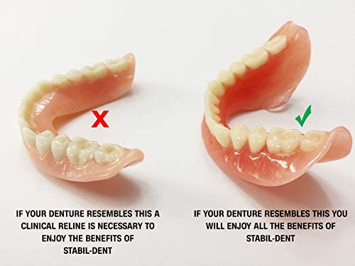 Lower Denture Stabilizers