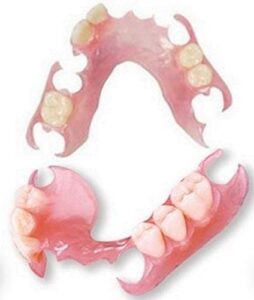 "nesbit bridge" , flipper uppler and lower set of affordability flexible valplast customized partial denture (pink, valplast)