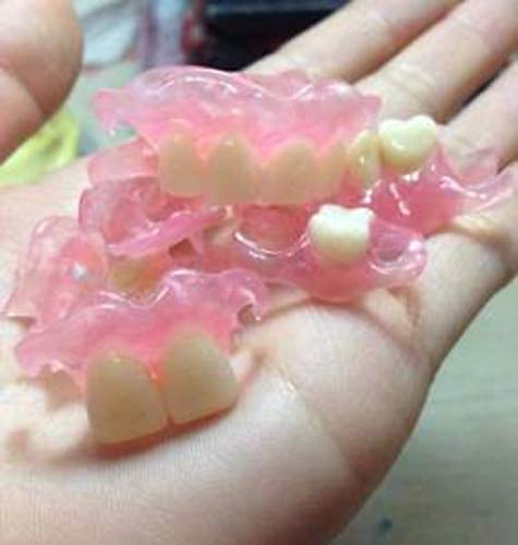 "Nesbit bridge" , Flipper Uppler and Lower Set of Affordability Flexible Valplast Customized Partial Denture (Pink, Valplast)