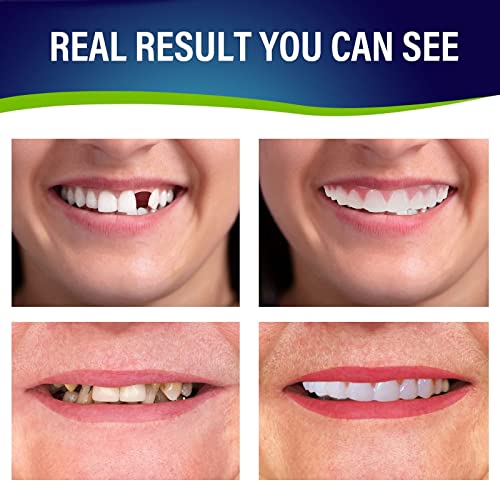 Fake Teeth, 2 Pcs Cosmetic Teeth, Comfort Upper and Lower jaw Denture, Protect Your Teeth, Regain Confident Smile