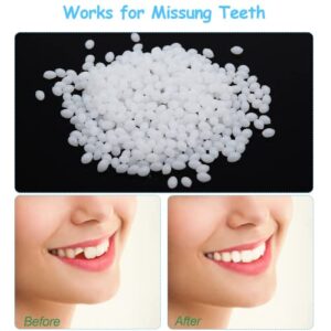 CAILING 6 Sets Instant Veneers Dentures, Teeth Covers for Bad Teeth for Snap Covering Missing Teeth Denture Filling Kit Super Smile Dentist