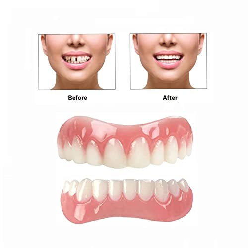 Fake Teeth - Upper and Lower Veneer - Dentures for Women and Men(2PCS)