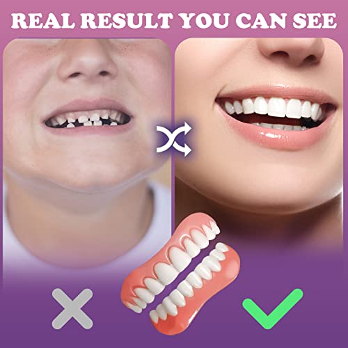 Fake Teeth, 2 PCS Veneers Dentures Socket for Women and Men, Dental Veneers for Temporary Tooth Repair Upper and Lower Jaw, Protect Your Teeth and Regain Confident Smile, Bright White-1-2