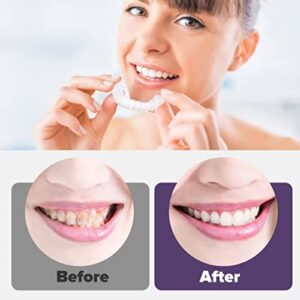 Fake Teeth,6PCS Dentures Cosmetic Teeth for Upper and Lower Jaw,Natural Shade and Comfortable Fit,Veneer Dentures for Women and Men-BB05