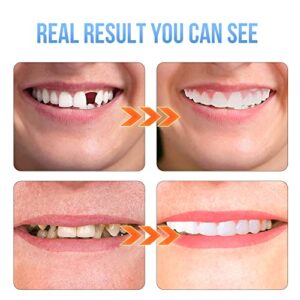 Fake Teeth,2PCS Dentures Cosmetic Teeth for Upper and Lower Jaw,Natural Shade and Comfortable Fit,Veneer Dentures for Women and Men-A03