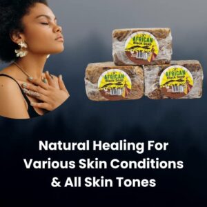 Infinix Shea Butter Face & Body Soap Bar for Oily Skin - 100% Natural African Black Soap with Pure Honey - Removes Dark Spots - Cleanses and Nourishes Skin