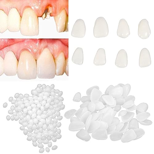 Tempoary Tooth Repair Kits DIY Dental Care Kit Glue for Filling Missing Broken Teeth Crowns and Bridges Moldable Fake Teeth to Regain Your Beautiful Smile in Minutes-White Color