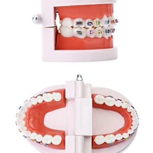 QWORK Typodonts Orthodontics Demonstration Model, Dental Tooth Research Model with Metal Wires and Ceramic Brackets, Teaching Teach Explanation Model for Adults
