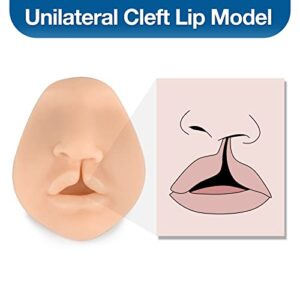 Ultrassist Unilateral Cleft Lip Model, Cleft Lip Suture Training Simulator for Medical Students, Education, Display