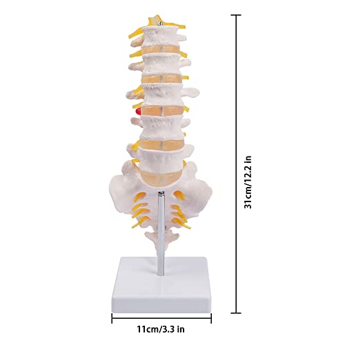 breesky Lumbar Spine Model - Life Size Human Lumbar Vertebrae Anatomy Model with Sacrum and Spinal Nerves Medical Chiropractor Medical Student Study Teaching Demonstration