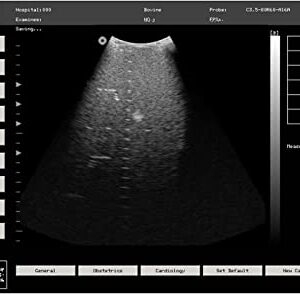 Portable Vet Veterinary B-Ultrasound Scanner，for Pregnancy，with Convex Probe for Horse,Goat,Cow,Sheep and Pig, CMS600P2 Vet CONTEC(Convex Probe)