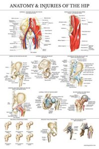 palace learning laminated anatomy and injuries of the hip poster - hip joint anatomical chart - 18" x 24"
