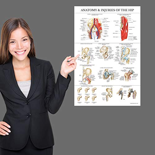 Palace Learning Laminated Anatomy and Injuries of the Hip Poster - Hip Joint Anatomical Chart - 18" x 24"