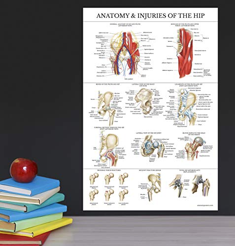 Palace Learning Laminated Anatomy and Injuries of the Hip Poster - Hip Joint Anatomical Chart - 18" x 24"