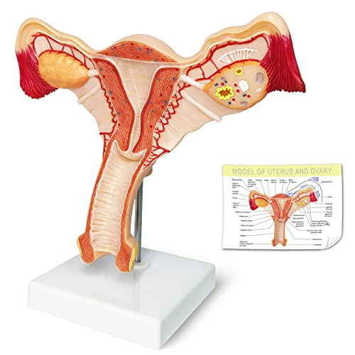 EVOTECH Human Uterus and Ovary Model, 2022 Newest Female Reproductive Organ Model, Female Genital Organ, Shows Uterus, Ovary, Vagina, Uterine Medical Teaching Anatomical Gynecology