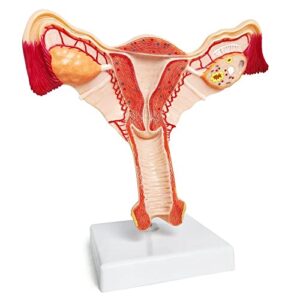 EVOTECH Human Uterus and Ovary Model, 2022 Newest Female Reproductive Organ Model, Female Genital Organ, Shows Uterus, Ovary, Vagina, Uterine Medical Teaching Anatomical Gynecology